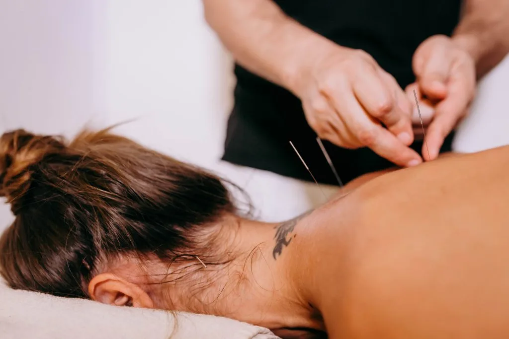 Dry needling